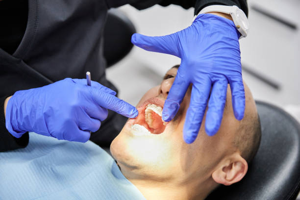 Best Emergency Treatment for Dental Infections or Abscesses in Ocala Estates, FL
